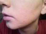 Тональный крем для проблемной кожи CLINIQUE Anti-Blemish Solutions Liquid Makeup фото