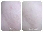 Тональный крем для проблемной кожи CLINIQUE Anti-Blemish Solutions Liquid Makeup фото