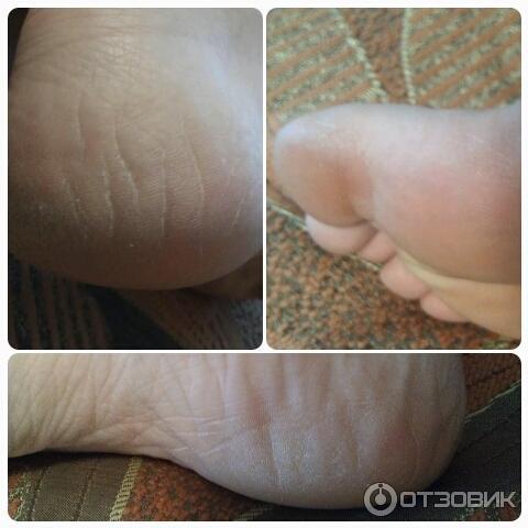 Японские носочки для педикюра Sosu с ароматом лаванды фото