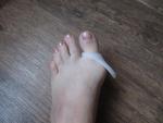 Ортопедическое изделие Valgus Pro для деформированного большого пальца фото