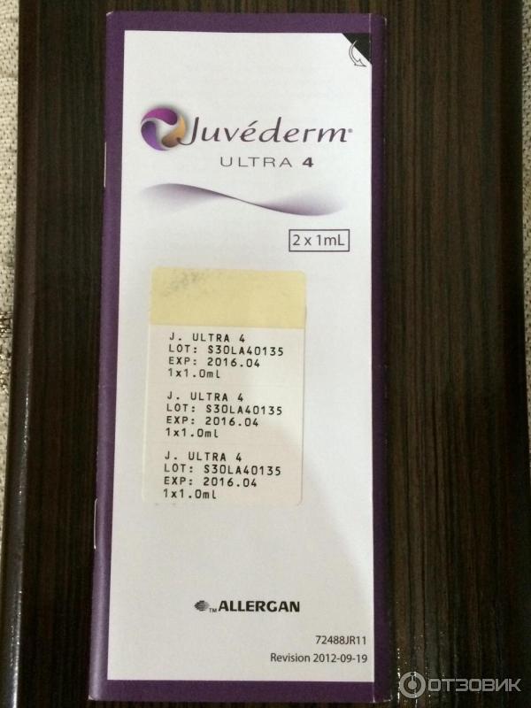 Коррекция морщин носогубных складок Juvederm Ultra 4 фото