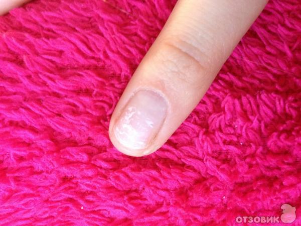 Маникюр. Оторванное покрытие. Снятие гель лака. Отслойка гель лака у кутикулы. Отслойка нарощенных ногтей.