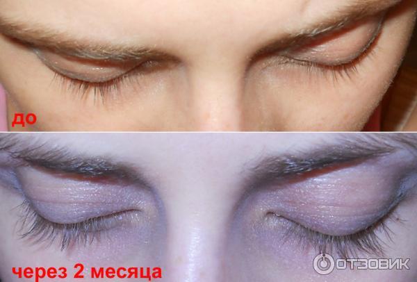 Купить карепрост для ресниц официальный сайт с доставкой - Красота