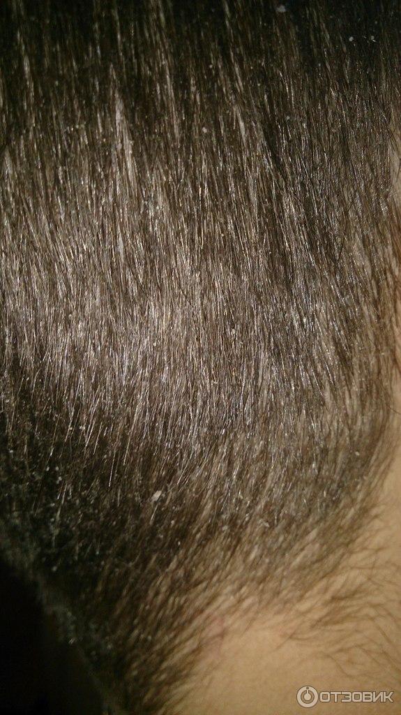 Шампунь Syoss Anti-Dandruff Control против перхоти фото