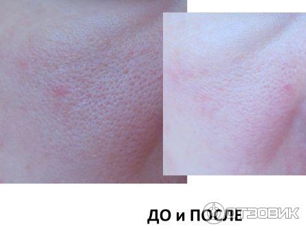 Сыворотка сужающая поры CLINIQUE Pore Minimizer Refining Serum фото