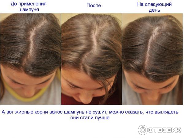 Free Sample Cambodian Hair Bundles,,Mech Human 100% Brazilian Virgin Cuticle Ali