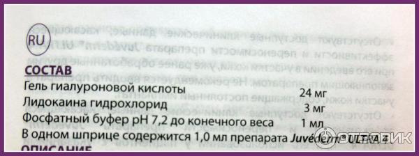 Коррекция морщин носогубных складок Juvederm Ultra 4 фото