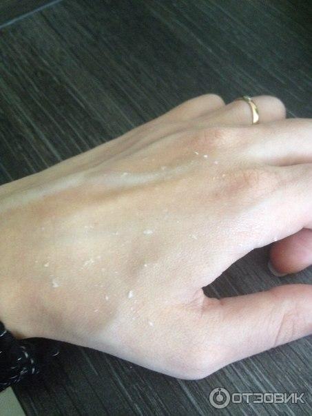 Катышки